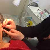 Photo prise pendant la puncture d'une oreille